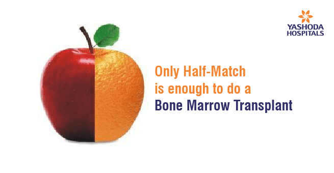 Bone Marrow Transplant (BMT)_Body 1