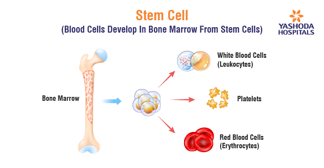 Bone Marrow Transplant (BMT)_Body 2