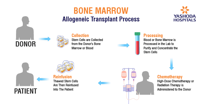 Bone Marrow Transplant (BMT)_Body 5