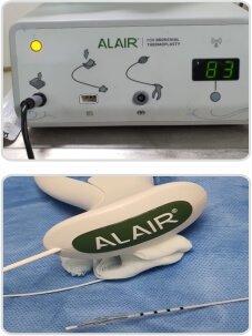 Bronchial Thermoplasty case-study