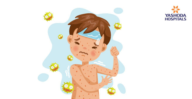 Common_Seasonal_Diseases_in_Children_Body1