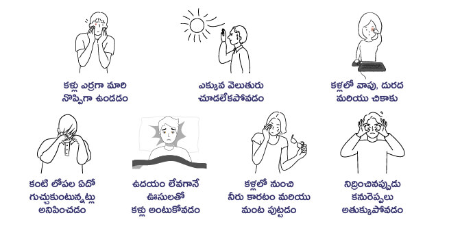 Conjunctivitis Symptoms