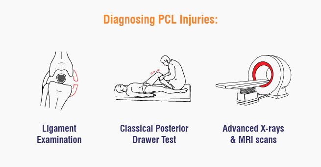 Understanding PCL Injuries_Body 2