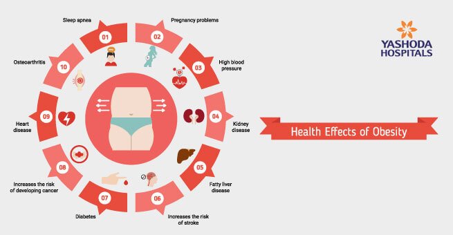 Health Effects of Obesity