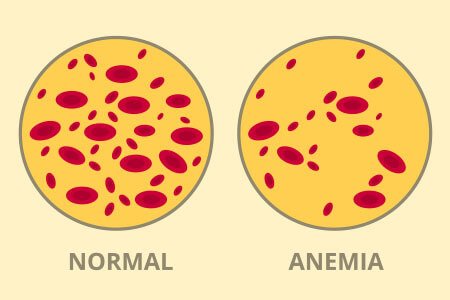 what is thalassemia