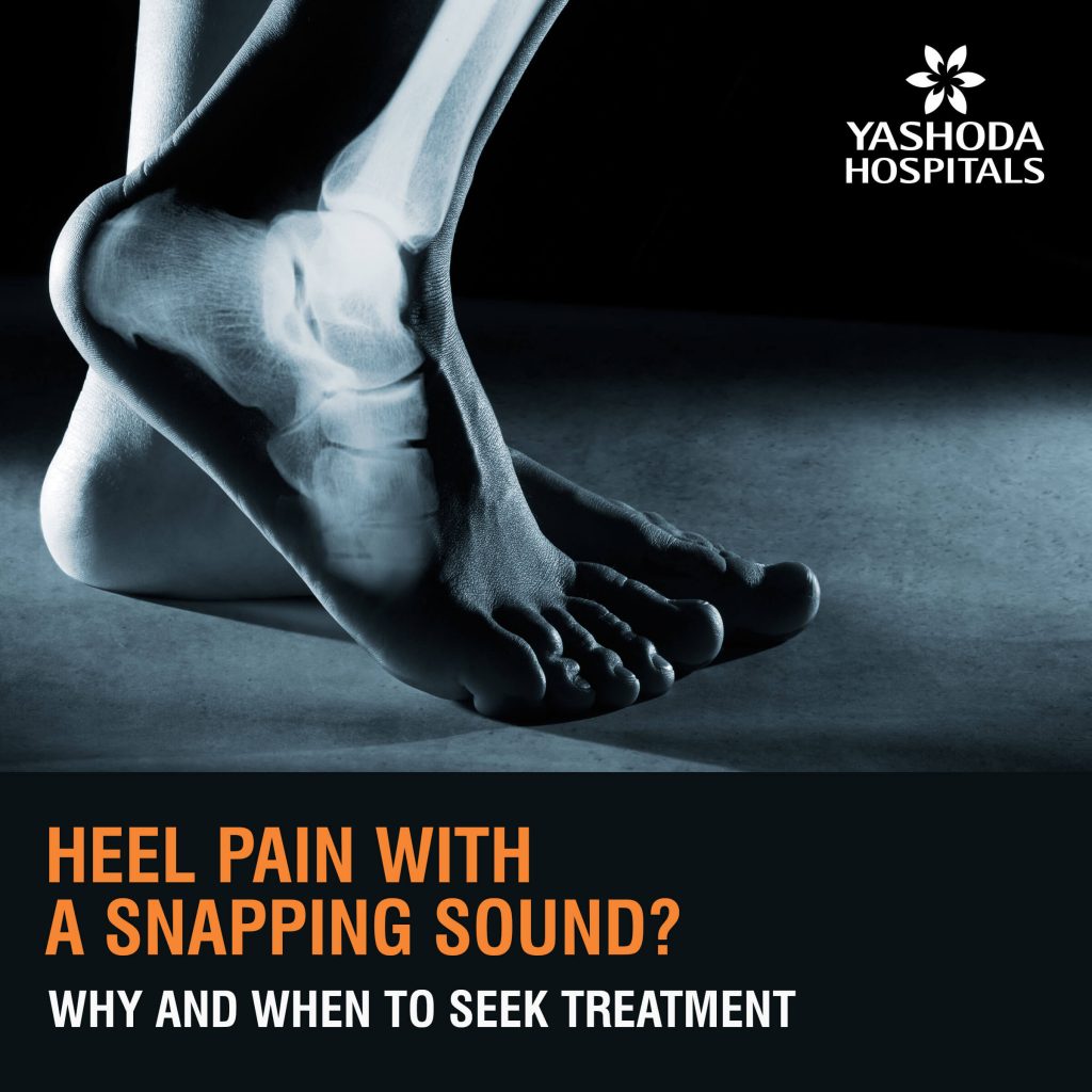 Heel Pain Causes Symptoms Diagnosis Prevention And Treatments